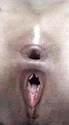 25P Dildo & Anal Gaping