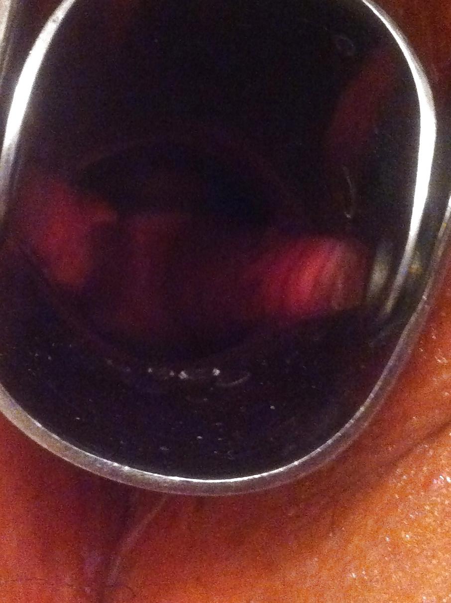 6P Speculum slut