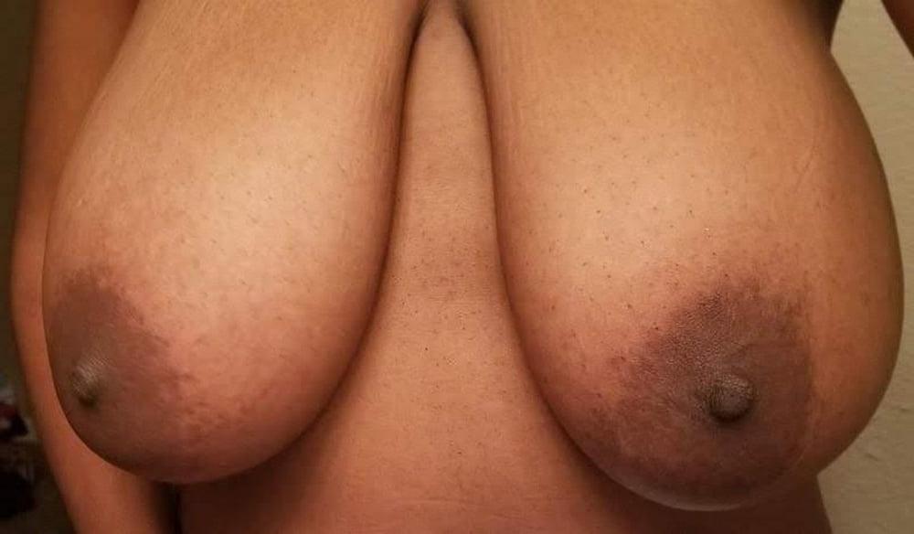 25P 1376