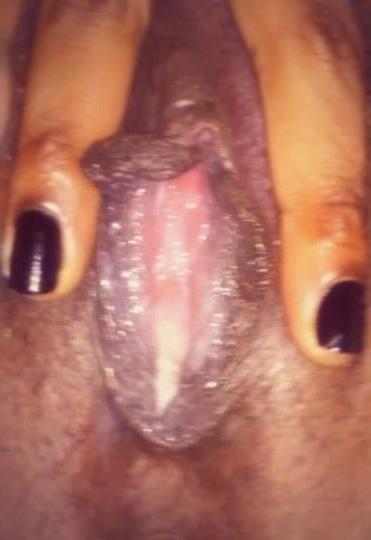 25P ATL whores 72