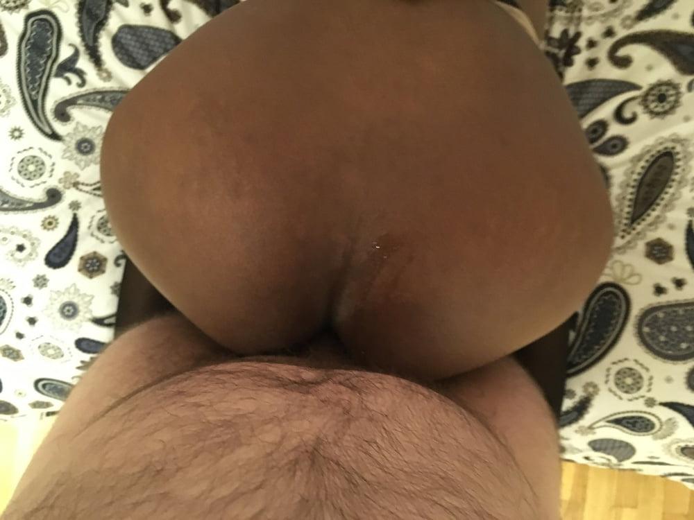 8P Anal