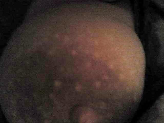 6P BEURETTE
