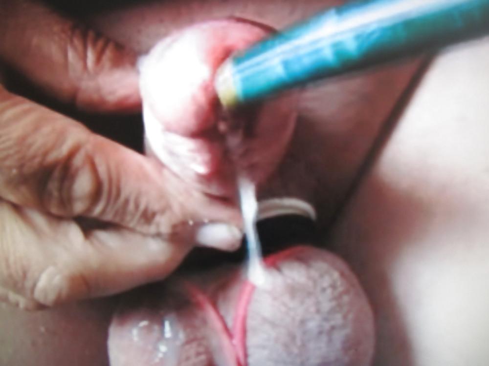 5P CBT INSERTION
