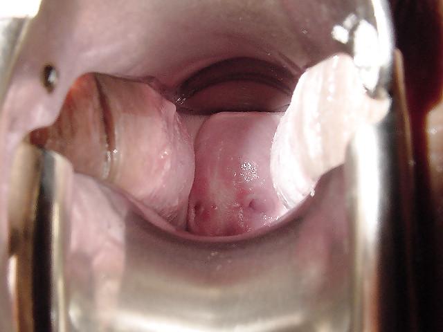 25P Tied tits and more  remix