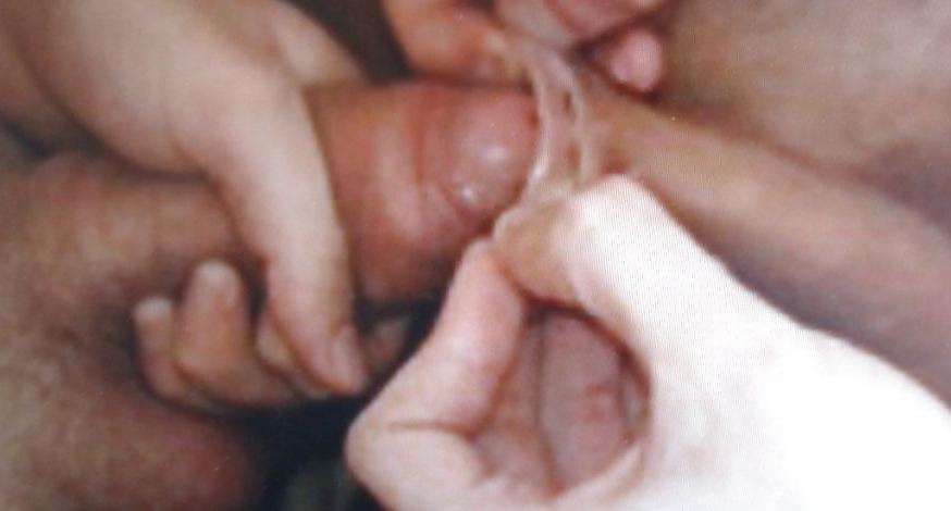 5P GAY PENIS