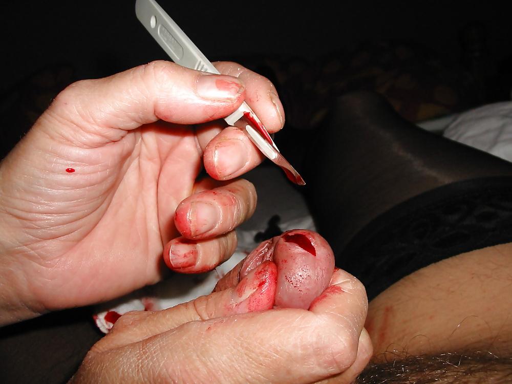 14P Cbt. needle
