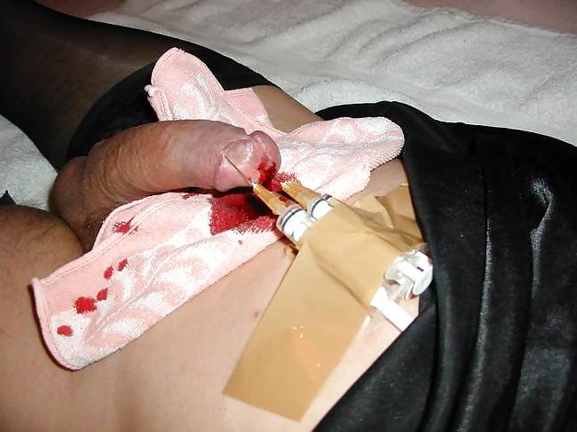 14P Cbt. needle