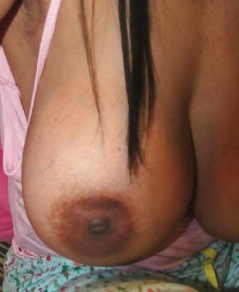 25P Heavy Massive Sagging Milf Slut Tits 