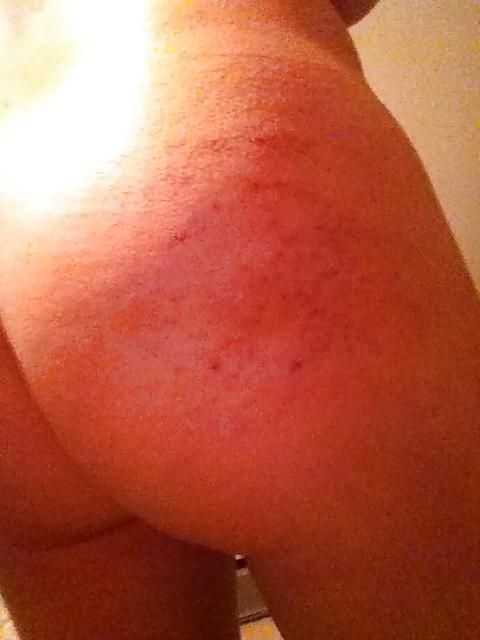 25P Various Pics of her spanked ass