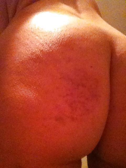 25P Various Pics of her spanked ass