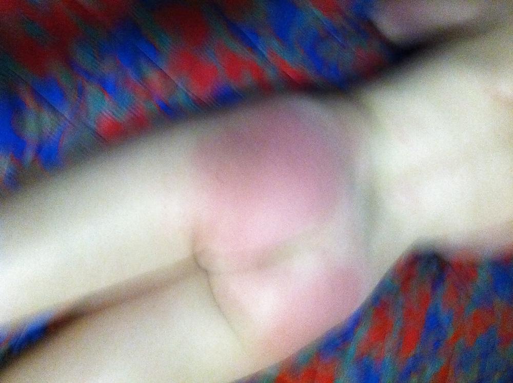 25P Various Pics of her spanked ass