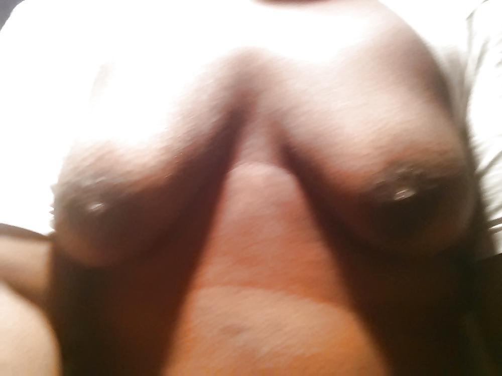 13P My man boobs