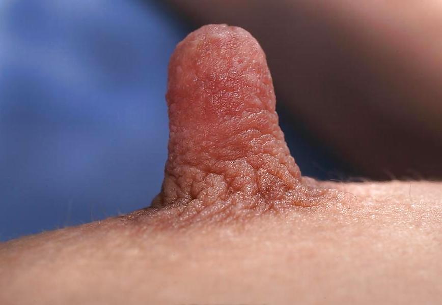 25P Big Nipples
