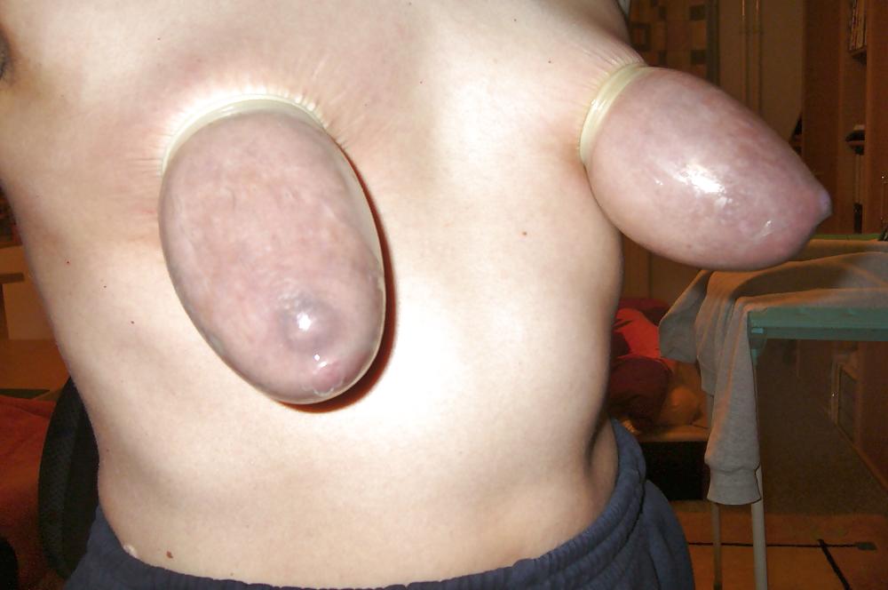 25P Breast Bondage 26