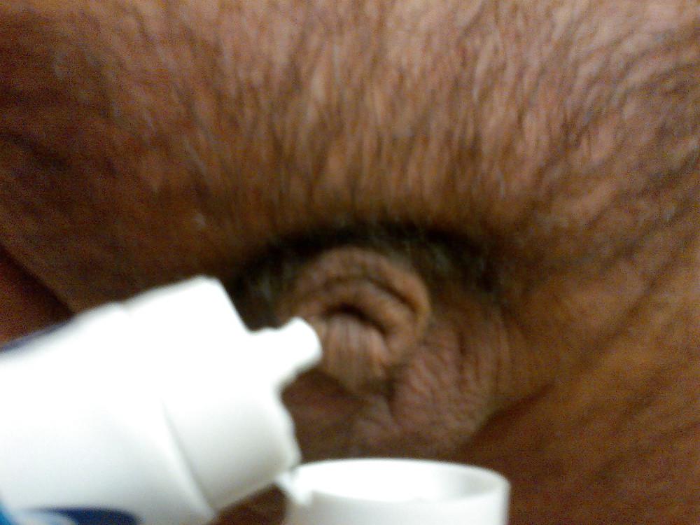 24P Icy hot cbt