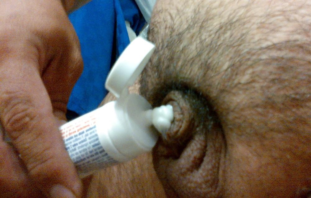 24P Icy hot cbt