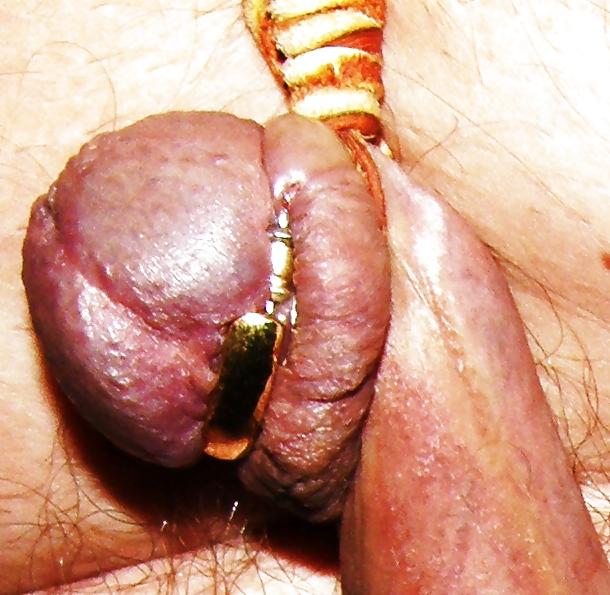 13P CBT