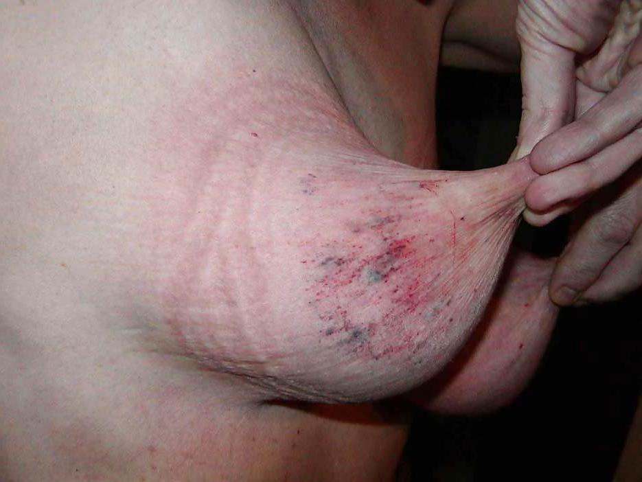 9P Destroyed tits
