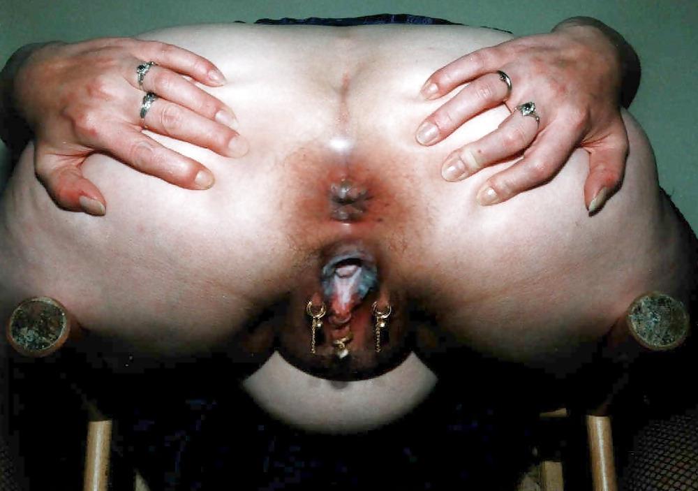 25P BONDAGE DILATATION SPECULUM