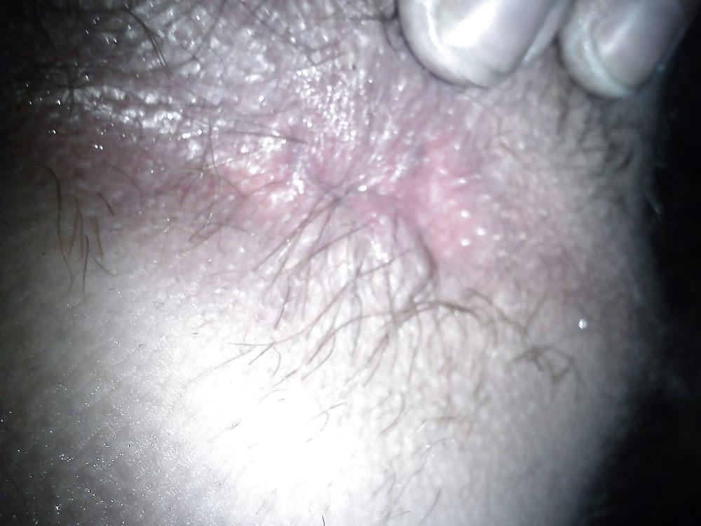 6P My butt hole needs a big hard