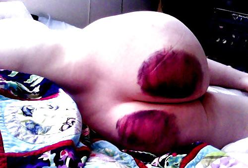 25P Spanked Asses 3 