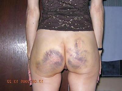 25P Spanked Asses 3 