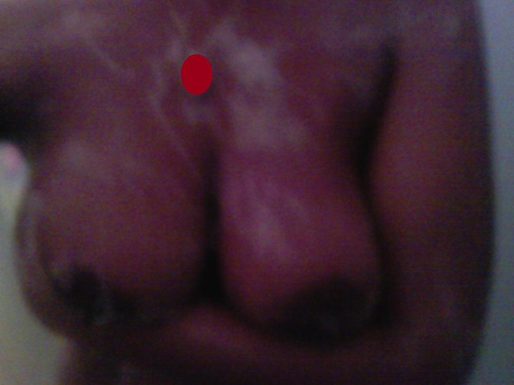 9P Random Amateur (Pt. 6)