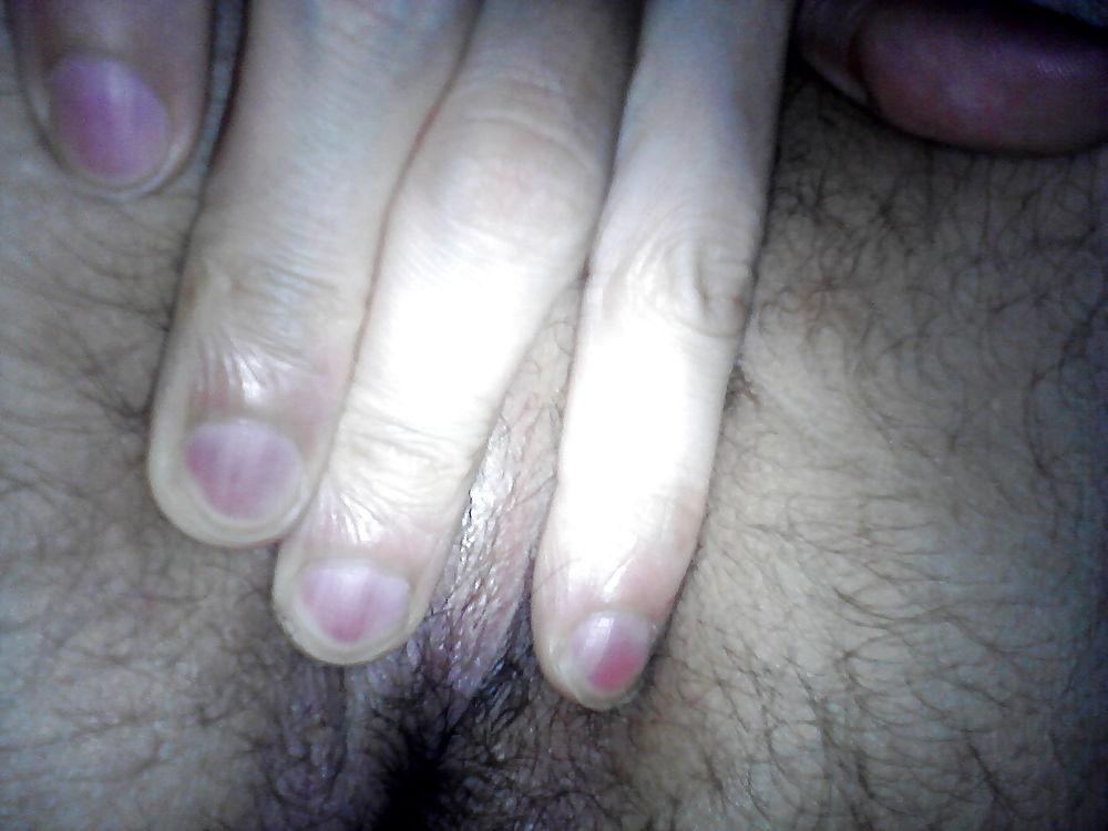 7P Me hole