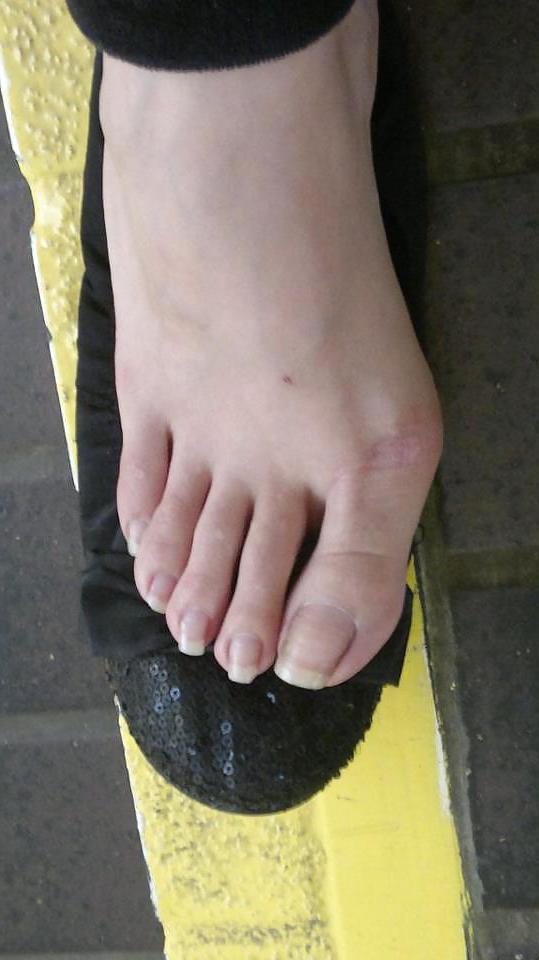 25P Indian and Pakistani with long toenails