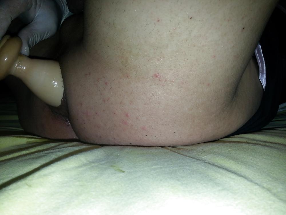 25P Inflatable plug and cock  bondage