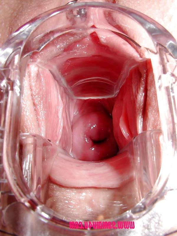 8P Speculum