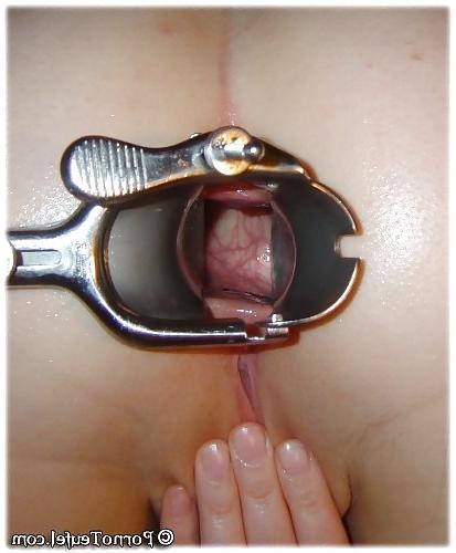 8P Speculum