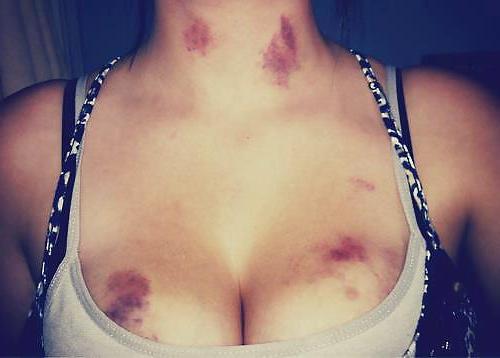 25P Big Tits Silicone Fake Boobs