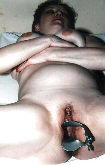 18P SPECULUM SPREDING