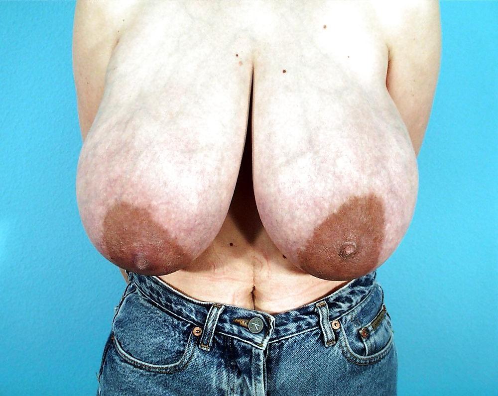 25P Big Natural And Saggy Tits Pre-OP Pictures