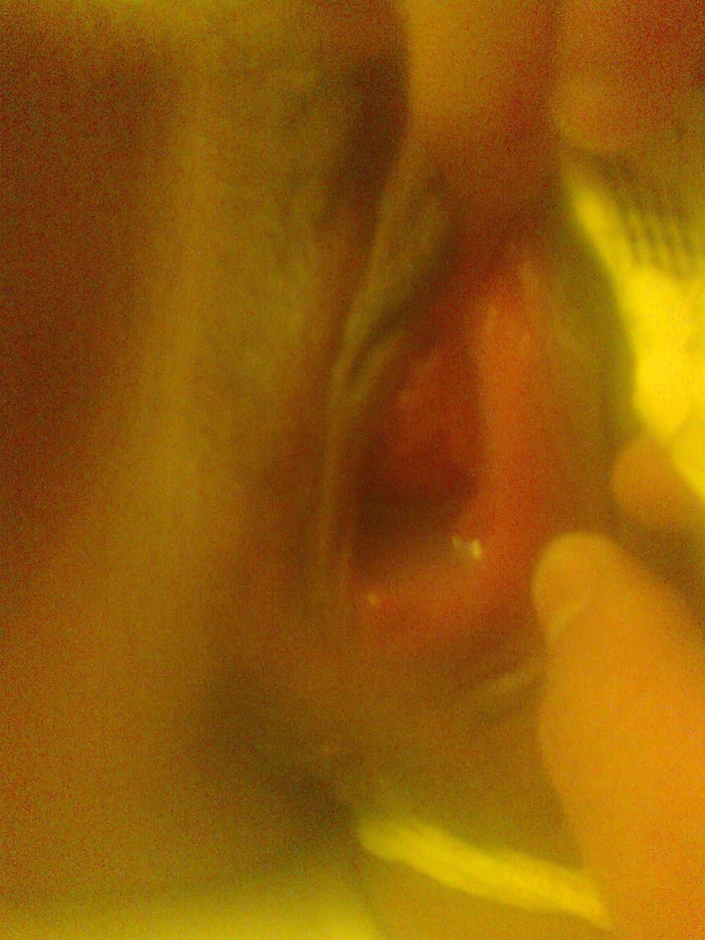 6P Beurette