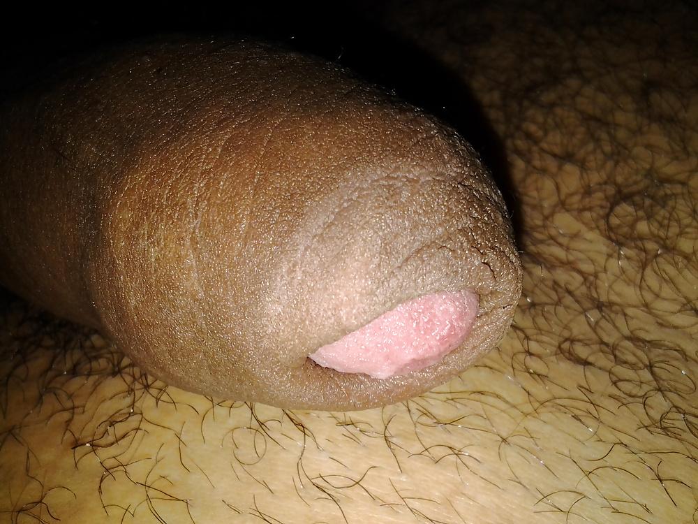 11P Uncut cock closeup