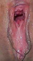 20P Gros plan 3
