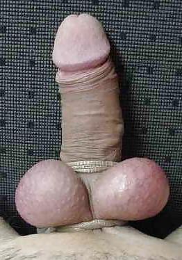 10P CBT