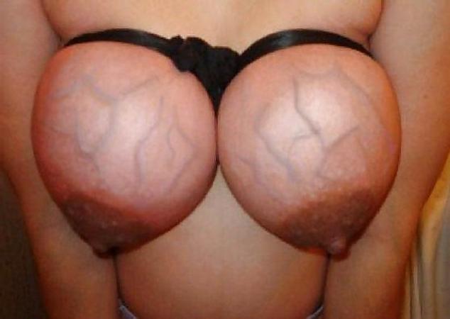 14P Bondage Titten