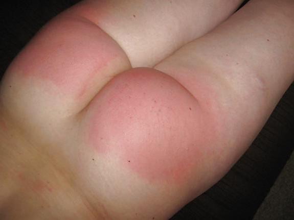 15P Spanked asses 10