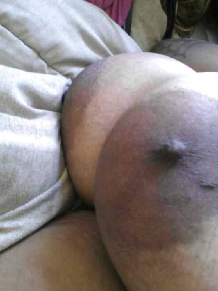 25P Big black areolas ----massive collection---- part 4