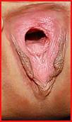 15P Gros plan 2