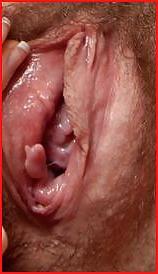 15P Gros plan 2