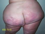 17P Fatty loves you B1