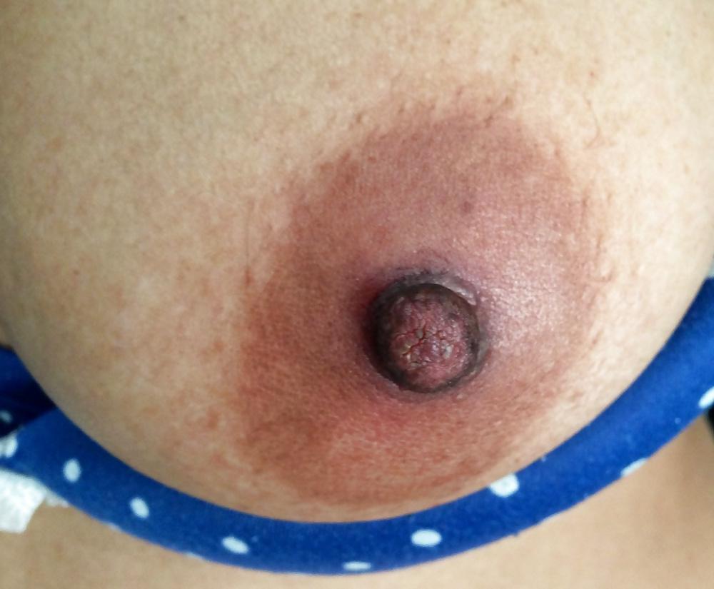 20P Ass, Boobs and Pussy