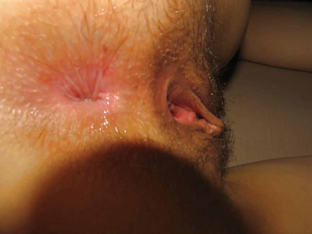 5P Horny hole