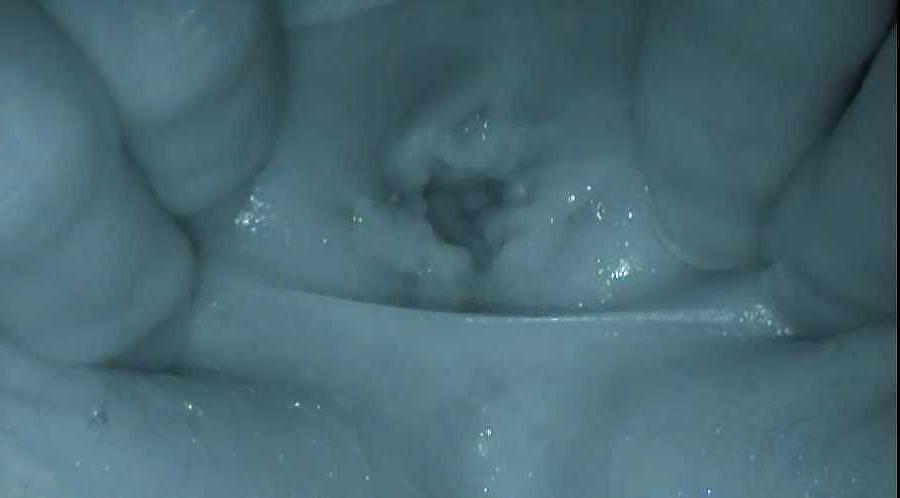 20P VOYEUR COUPLE 4