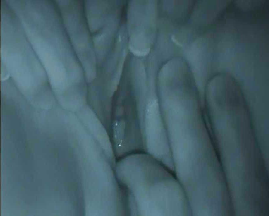 20P VOYEUR COUPLE 4