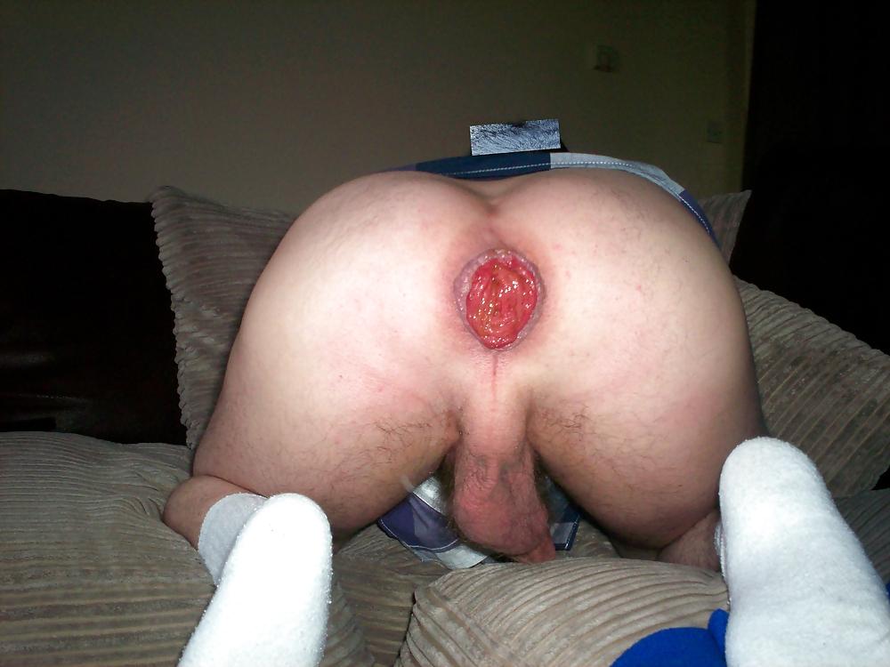 12P Man hole exposed
